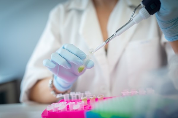 ValGenetics analiza el CYVCV en cítricos con técnicas moleculares